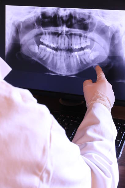 Best Tooth Infection Emergency Dentist  in Reese, MI