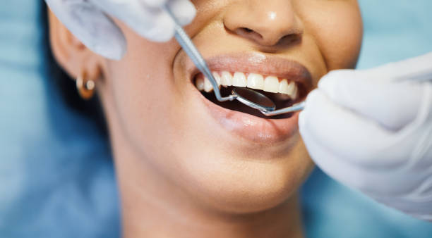 Best Knocked-Out Tooth Emergency  in Reese, MI